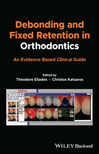Debonding and Fixed Retention in Orthodontics – An  Evidence–Based Clinical Guide - An Evidence-Based Clinical Guide