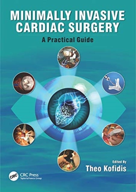Minimally Invasive Cardiac Surgery - A Practical Guide