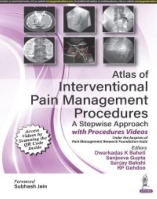 Atlas of Interventional Pain Management Procedures - A Stepwise Approach