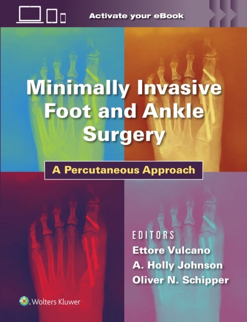 Minimally Invasive Foot and Ankle Surgery - A Percutaneous Approach