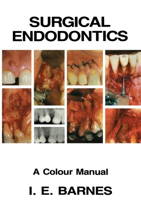 Surgical Endodontics - A Colour Manual