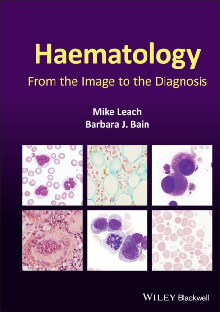 Haematology – From the Image to the Diagnosis - From the Image to the Diagnosis