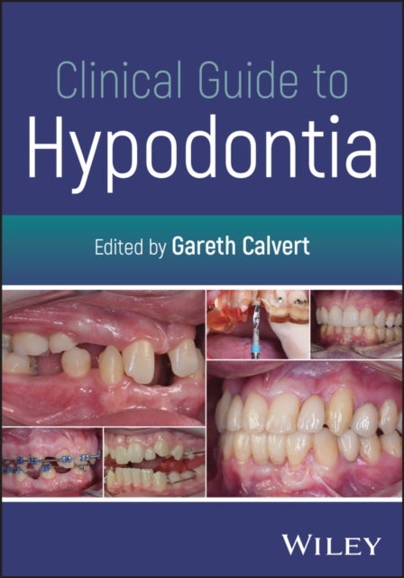 Clinical Guide to Hypodontia
