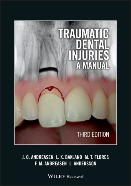 Traumatic Dental Injuries – A Manual 3e - A Manual