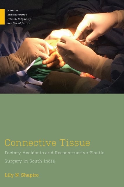 Connective Tissue – Factory Accidents and Reconstructive Plastic Surgery in South India - Factory Accidents and Reconstructive Plastic Surgery in South India