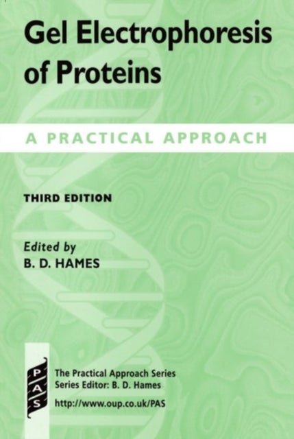 Gel Electrophoresis of Proteins - A Practical Approach