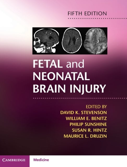 Fetal and Neonatal Brain Injury