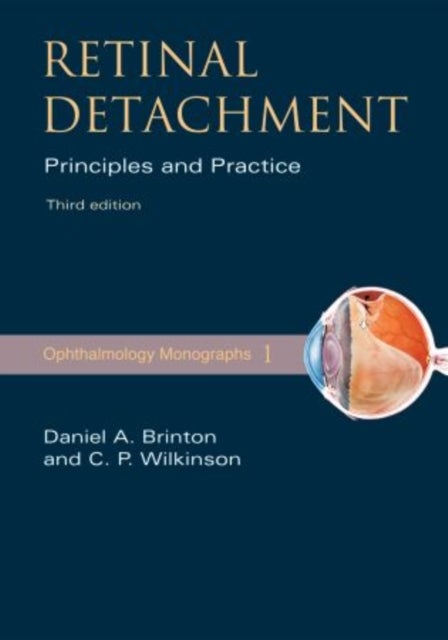 Retinal Detachment - Priniciples and Practice