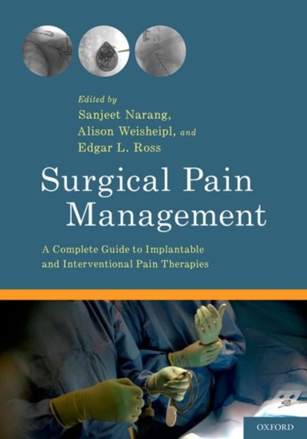 Surgical Pain Management - A Complete Guide to Implantable and Interventional Pain Therapies