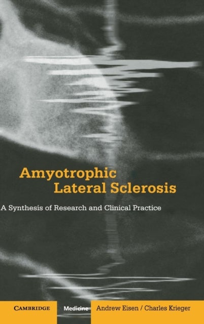 Amyotrophic Lateral Sclerosis - A Synthesis of Research and Clinical Practice
