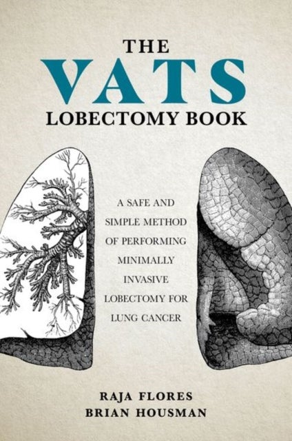 The VATS Lobectomy Book - A Safe and Simple Method of Performing Minimally Invasive Lobectomy for Lung Cancer