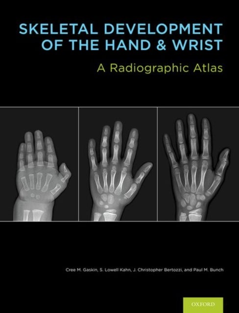 Skeletal Development of the Hand and Wrist - A Radiographic Atlas and Digital Bone Age Companion