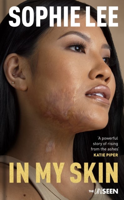 In My Skin – Learning to love your perfectly imperfect life - Learning to love your perfectly imperfect life