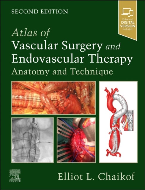 Atlas of Vascular Surgery and Endovascular Therapy - Anatomy and Technique