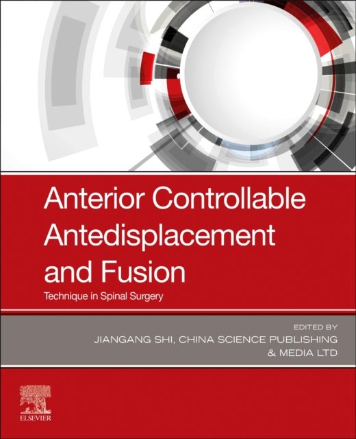 Anterior Controllable Antedisplacement and Fusion - Technique in Spinal Surgery