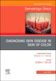 Diagnosing Skin Disease in Skin of Color, An Issue of Dermatologic Clinics