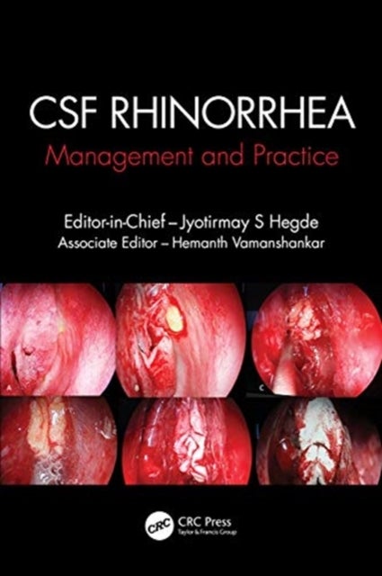 Cerebrospinal Fluid Rhinorrhea - Management and Practice