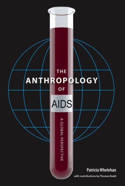 The Anthropology of AIDS - A Global Perspective