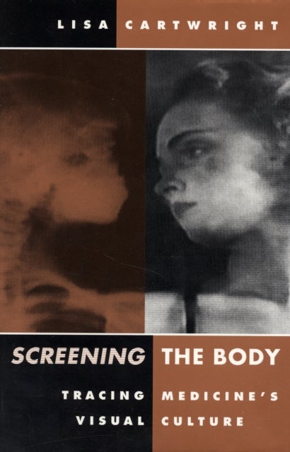 Screening the Body - Tracing Medicine's Visual Culture