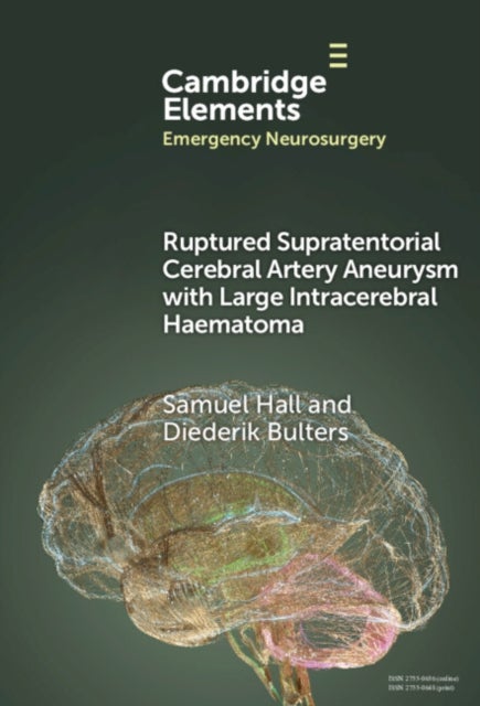 Ruptured Supratentorial Cerebral Artery Aneurysm With Large Intracerebral Haematoma