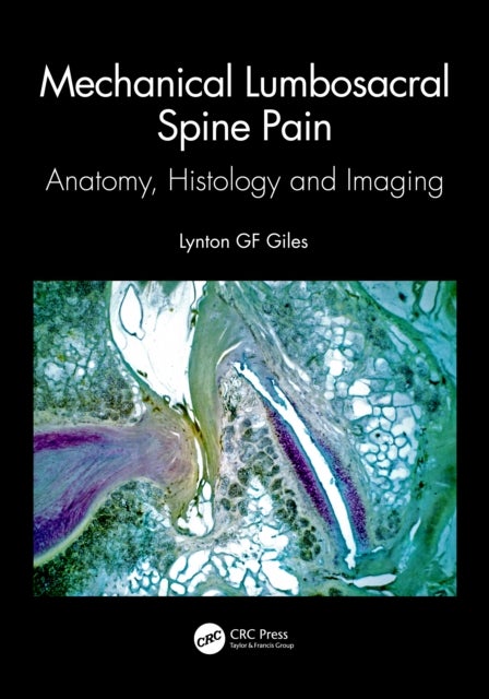 Mechanical Lumbosacral Spine Pain - Anatomy, Histology and Imaging