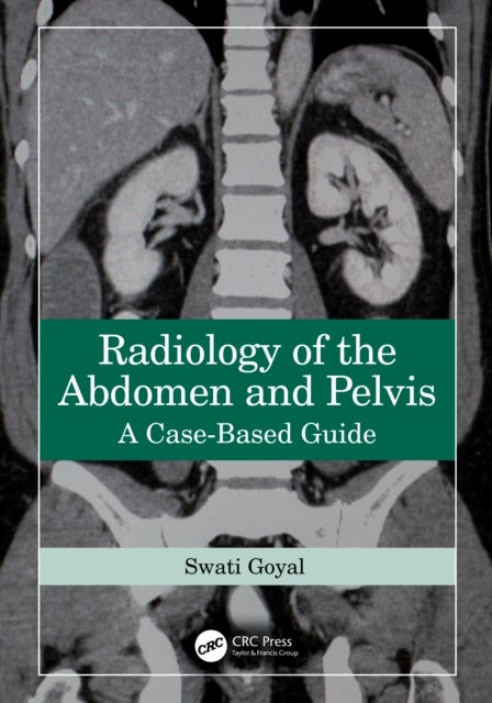 Radiology of the Abdomen and Pelvis - A Case-Based Guide