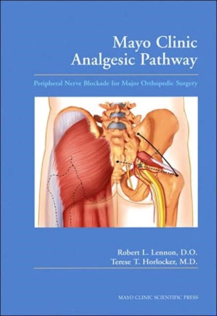 Mayo Clinic Analgesic Pathway - Peripheral Nerve Blockade for Major Orthopedic Surgery