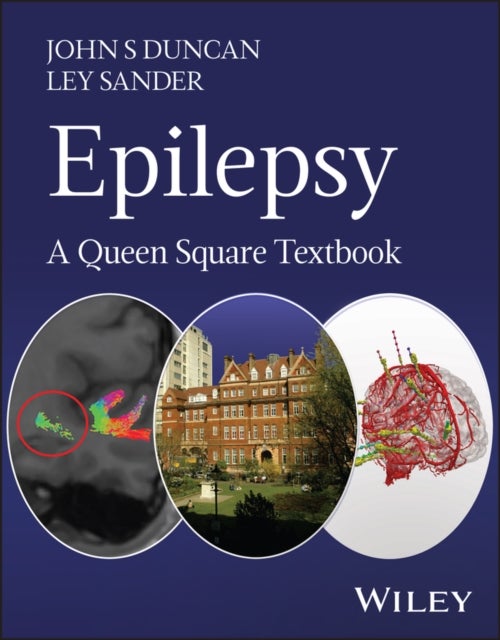 Epilepsy - A Queen Square Textbook