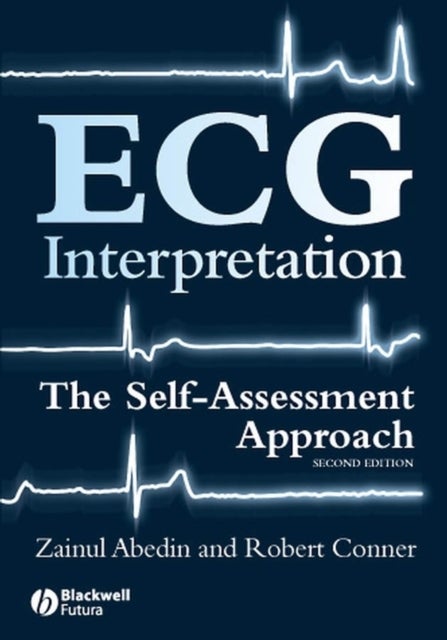 ECG Interpretation – The Self–Assessment Approach 2e - The Self-Assessment Approach