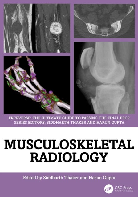 Musculoskeletal Radiology - An Ultimate Guide to Passing the Final FRCR