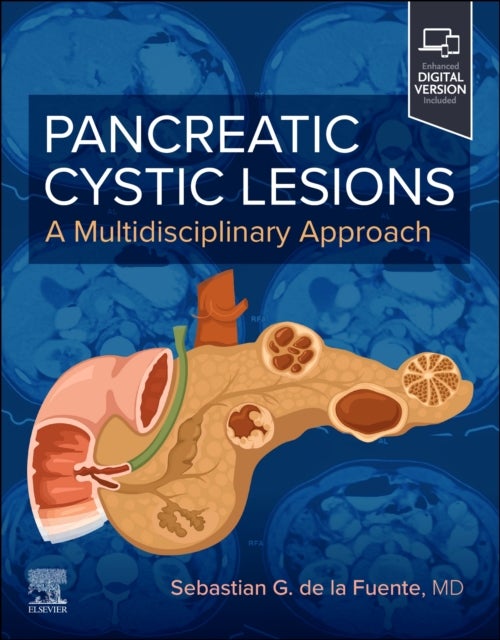 Pancreatic Cystic Lesions: A Multidisciplinary Approach - A Multidisciplinary Approach