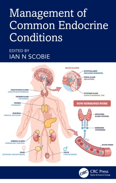 Management of Common Endocrine Conditions