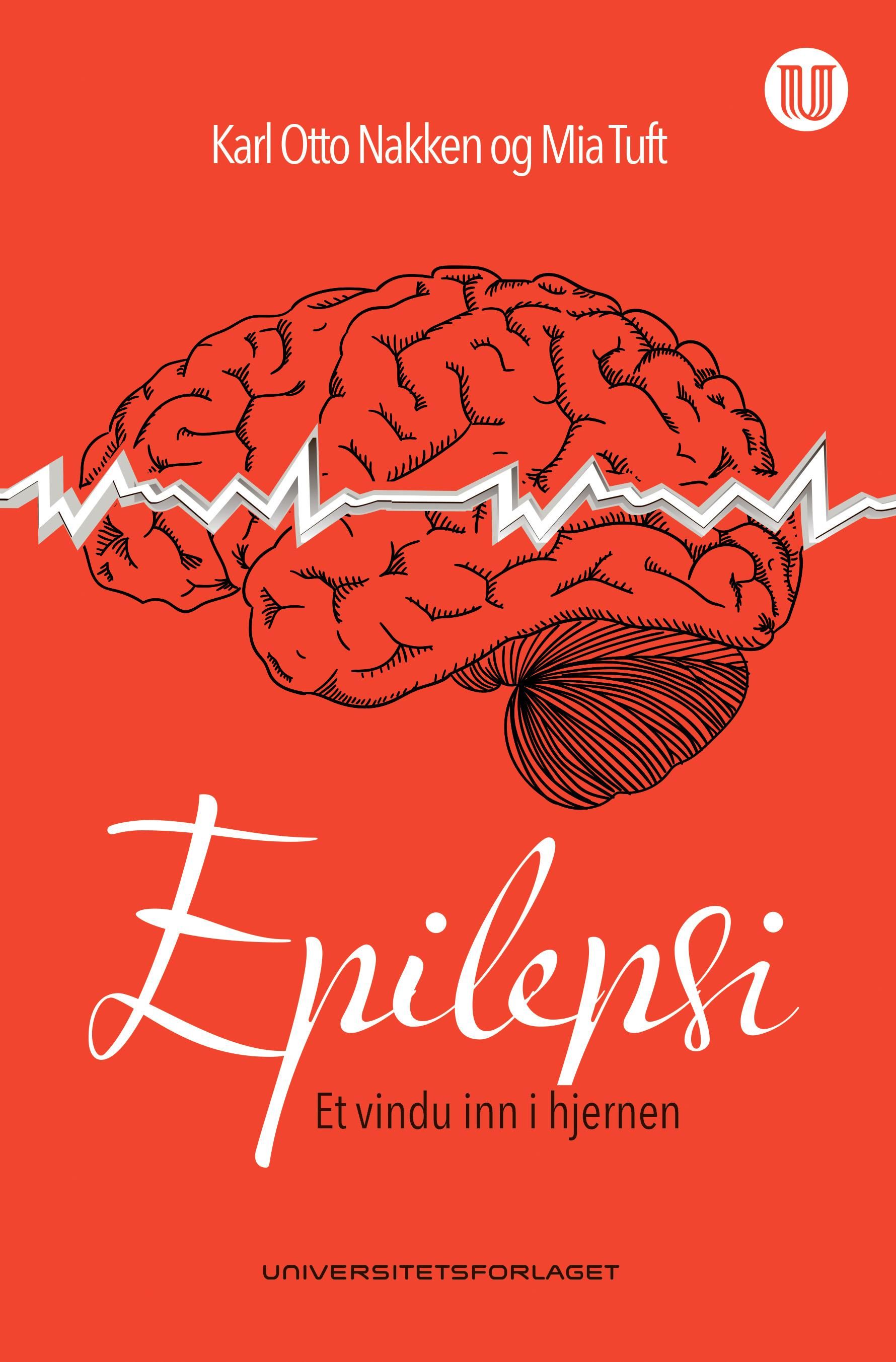 Epilepsi - et vindu inn i hjernen