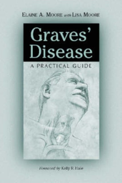 Graves' Disease - A Practical Guide