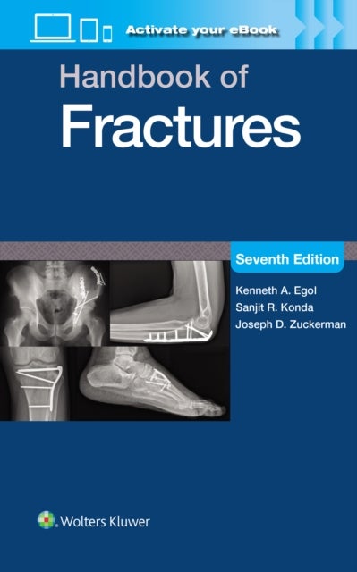 Handbook of Fractures: Print + eBook with Multimedia