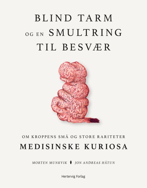Blind tarm og en smultring til besvær - om kroppens små og store rariteter : medisinske kuriosa