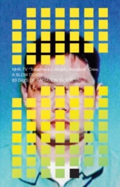 A Slow Death - 83 Days of Radiation Sickness