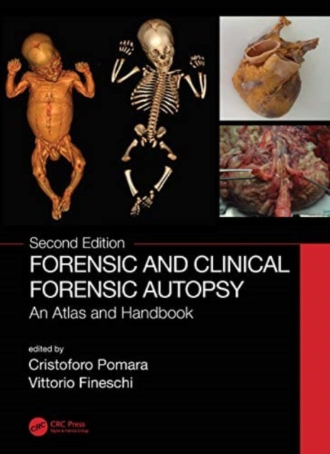 Forensic and Clinical Forensic Autopsy - An Atlas and Handbook