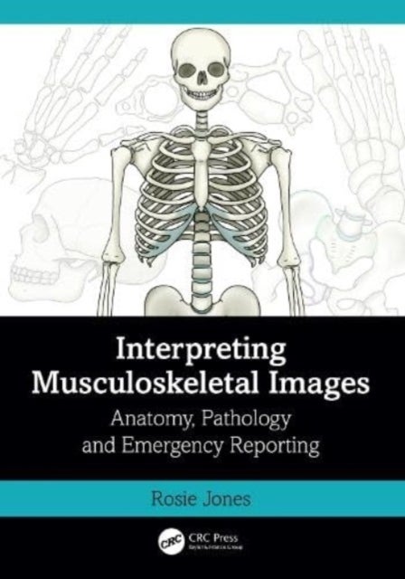 Interpreting Musculoskeletal Images - Anatomy, Pathology and Emergency Reporting