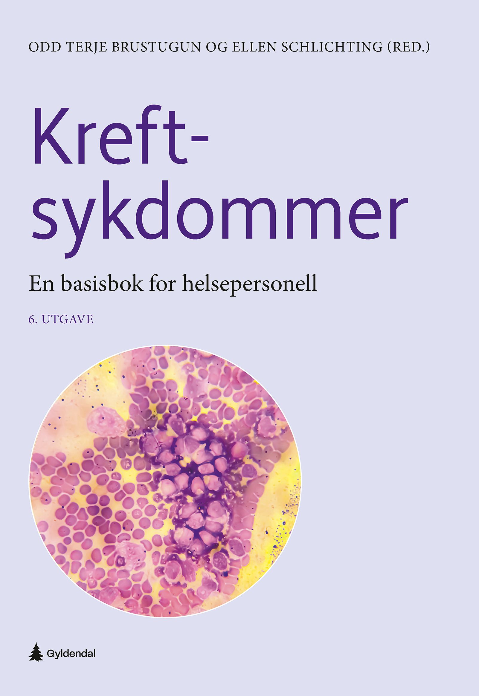 Kreftsykdommer - En basisbok for helsepersonell
