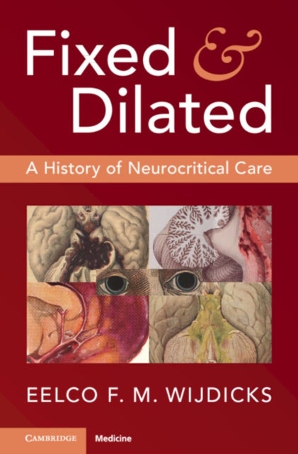 Fixed and Dilated - A History of Neurocritical Care