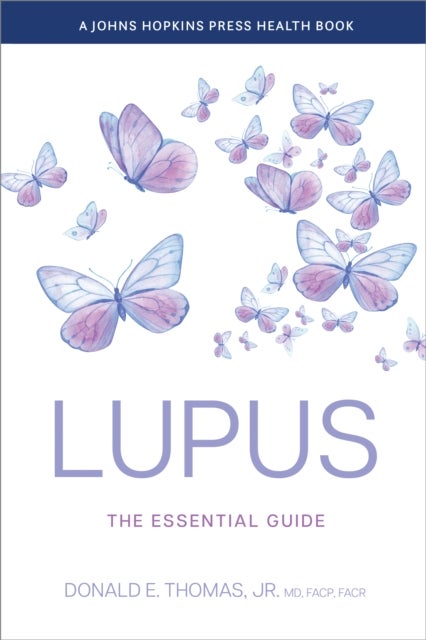 Lupus - The Essential Guide