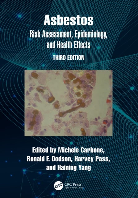 Asbestos - Risk Assessment, Epidemiology, and Health Effects