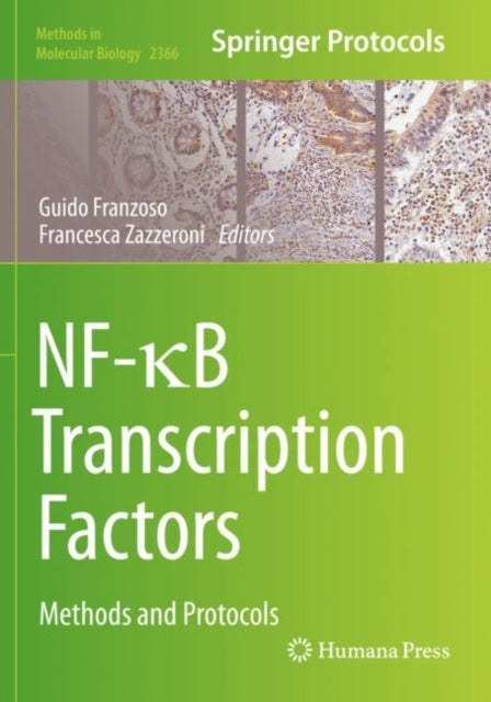 NF-?B Transcription Factors - Methods and Protocols