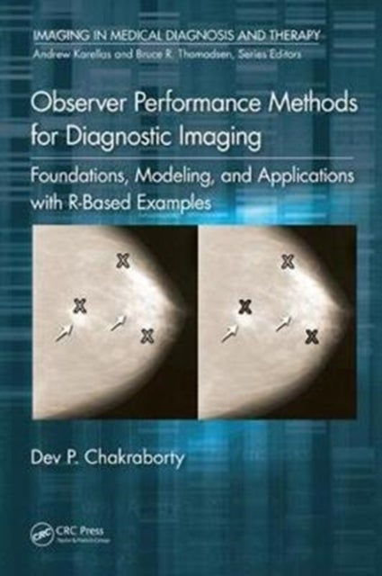 Observer Performance Methods for Diagnostic Imaging - Foundations, Modeling, and Applications with R-Based Examples