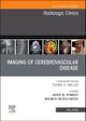 Imaging of Cerebrovascular Disease, An Issue of Radiologic Clinics of North America