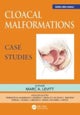 Cloacal Malformations: Case Studies