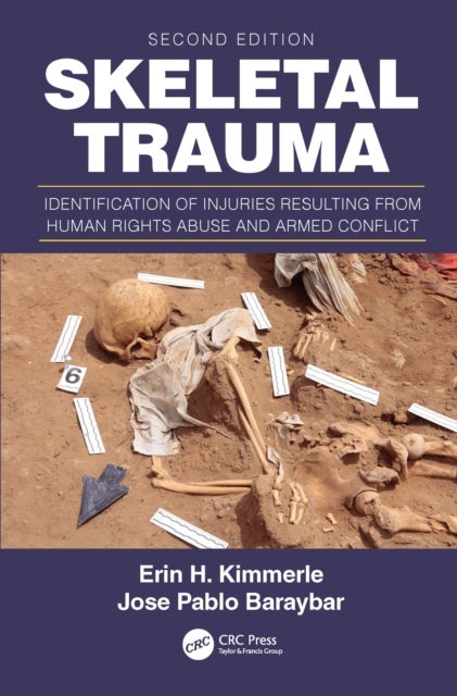 Skeletal Trauma - Identification of Injuries Resulting from Human Rights Abuse and Armed Conflict