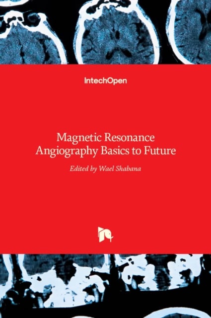 Magnetic Resonance Angiography - Basics to Future