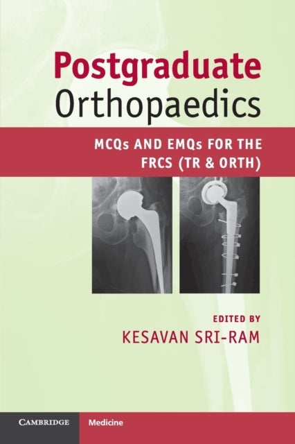 Postgraduate Orthopaedics - MCQs and EMQs for the FRCS (Tr & Orth)